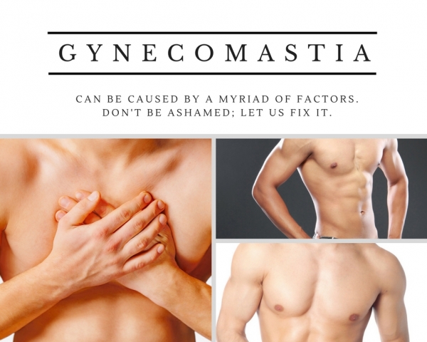 Peña Manuel - Gynecomastia Collage