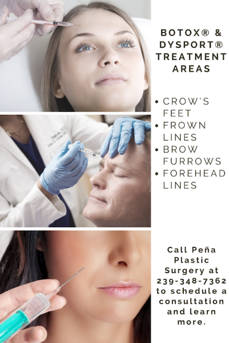 Diagram of BOTOX® Cosmetic treatment areas
