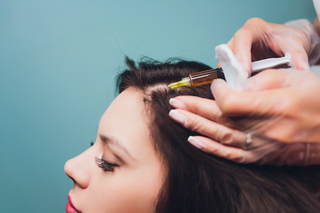 Woman receiving hair restoration treatment